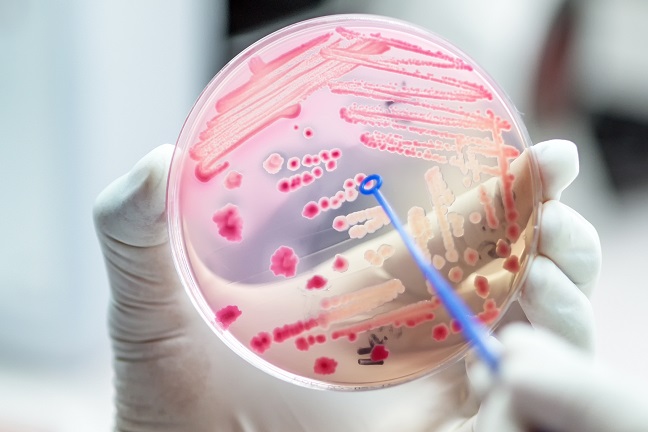 微生物科医院麦康基琼脂上发酵乳糖的粉红色大肠杆菌菌落。.jpg
